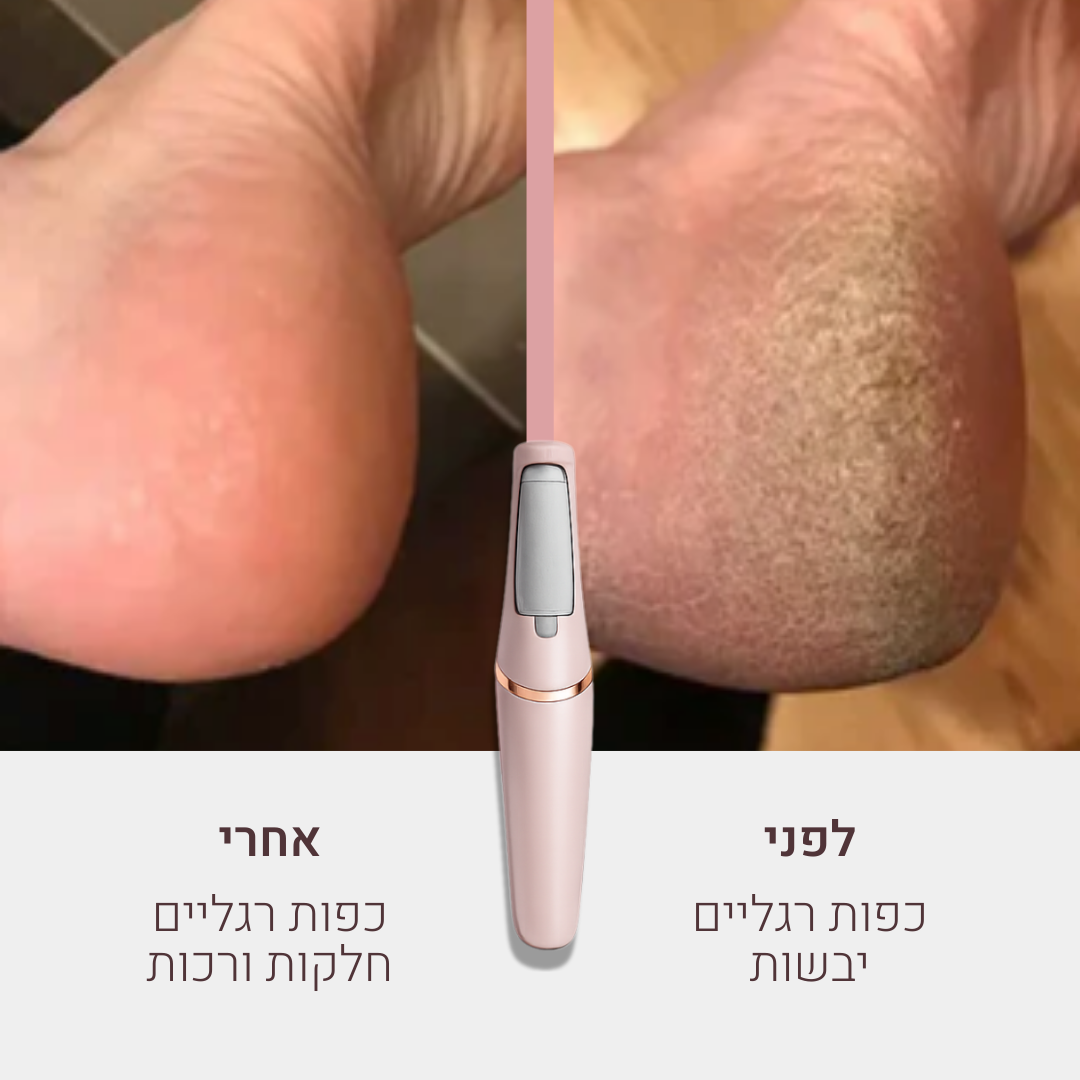 Silky מכשיר פדיקור ביתי